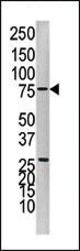 Anti-PTPN1 Rabbit Polyclonal Antibody