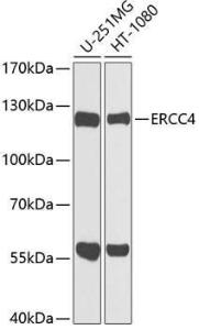 Western blot analysis of extracts of various cell lines, using Anti-XPF Antibody (A12212) at 1:1,000 dilution. The secondary antibody was Goat Anti-Rabbit IgG H&L Antibody (HRP) at 1:10,000 dilution.