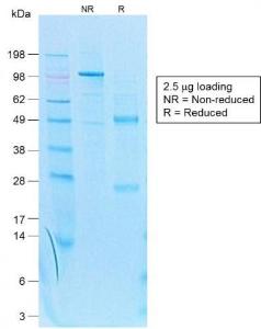 SDS-PAGE analysis of Anti-Cytokeratin 7 Antibody [KRT7/1499R] under non-reduced and reduced conditions; showing intact IgG and intact heavy and light chains, respectively. SDS-PAGE analysis confirms the integrity and purity of the antibody