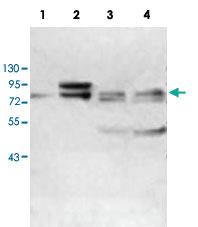 Anti-ABCF3 Rabbit Polyclonal Antibody