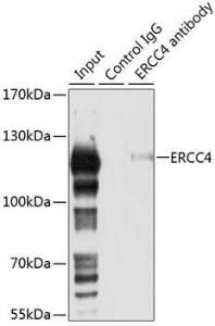 Immunoprecipitation analysis of 150µg extracts of 293T cells using 3µg of Anti-XPF Antibody (A12212). This Western blot was performed on the immunoprecipitate using Anti-XPF Antibody (A12212) at a dilution of 1:1000.