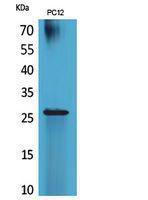 Western blot analysis of PC12 cells using Anti-POLR3G Antibody