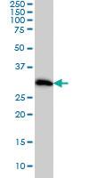 Anti-CDK4 Mouse Monoclonal Antibody [clone: 2A1]