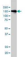 Anti-INPPL1 Mouse Monoclonal Antibody [clone: 3E6]