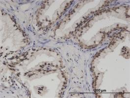 Anti-SMARCA5 Mouse Monoclonal Antibody [clone: 3F4]