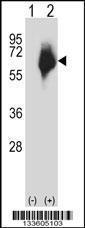 Anti-MMP2 Rabbit Polyclonal Antibody