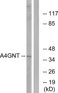 Western blot analysis of lysates from K562 cells using Anti-A4GNT Antibody. The right hand lane represents a negative control, where the antibody is blocked by the immunising peptide.