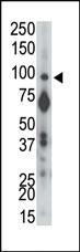 Anti-PTP alpha Rabbit Polyclonal Antibody