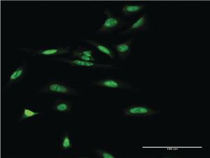 Anti-SMARCA5 Mouse Monoclonal Antibody [clone: 3F4]