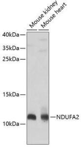 Western blot analysis of extracts of various cell lines, using Anti-NDUFA2 Antibody (A12213) at 1:1,000 dilution. The secondary antibody was Goat Anti-Rabbit IgG H&L Antibody (HRP) at 1:10,000 dilution.