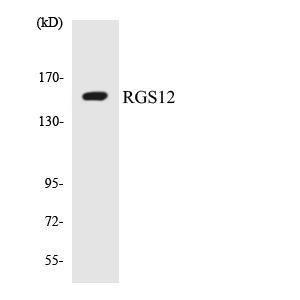 Western blot analysis of the lysates from HUVEC cells using Anti-RGS12 Antibody