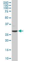 Anti-CDK4 Mouse Monoclonal Antibody [clone: 2A1]