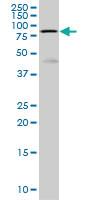 Anti-HCLS1 Mouse Monoclonal Antibody [clone: 3D5]