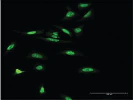 Anti-SMARCA5 Mouse Monoclonal Antibody [clone: 3F4]