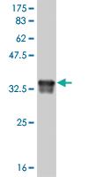 Anti-DEAF1 Mouse Monoclonal Antibody [clone: 1H8]