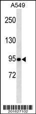 Anti-TLE1 Mouse Monoclonal Antibody (AP (Alkaline Phosphatase)) [clone: 381CT18.5.1]