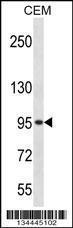 Anti-ADRBK2 Rabbit Polyclonal Antibody (APC (Allophycocyanin))