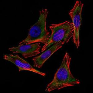 Immunofluorescent analysis of A2058 cells stained with Anti-S100 beta Antibody [4C4.9 + S100B/1012] (AF488) (Green). F-actin filaments were labeled with DyLight 554 Phalloidin (Red). DAPI was used to stain the cell nuclei (Blue)