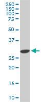 Anti-CDK4 Mouse Monoclonal Antibody [clone: 2A1]