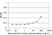 Anti-SMARCA5 Mouse Monoclonal Antibody [clone: 3F4]