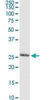 Anti-C8ORF33 Rabbit Polyclonal Antibody