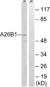 Western blot analysis of lysates from Jurkat cells using Anti-A26B1 Antibody. The right hand lane represents a negative control, where the antibody is blocked by the immunising peptide