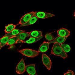 Immunofluorescent analysis of HeLa cells stained with Anti-SET Antibody [PCRP-SET-1C6] followed by Goat Anti-Mouse IgG (CF&#174; 488) (Green). Counterstain is Phalloidin-CF&#174; 640A (Red)