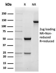 SDS-PAGE analysis of Anti-alpha II Spectrin Antibody [SPTAN1/3506] under non-reduced and reduced conditions; showing intact IgG and intact heavy and light chains, respectively. SDS-PAGE analysis confirms the integrity and purity of the antibody