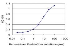 Anti-CDK4 Mouse Monoclonal Antibody [clone: 2A1]