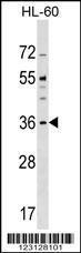 Anti-CENPO Rabbit Polyclonal Antibody (HRP (Horseradish Peroxidase))