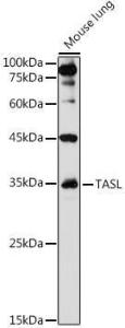 Western blot analysis of extracts of Mouse lung, using Anti-TASL Antibody (A308062) at 1:1,000 dilution