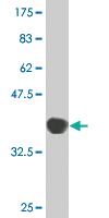 Anti-TPO Mouse Monoclonal Antibody [clone: 2A11]