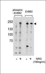 Anti-ERBB2 Rabbit Polyclonal Antibody (FITC (Fluorescein Isothiocyanate))