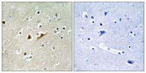 Immunohistochemical analysis of paraffin-embedded human brain tissue using Anti-RGAP1 Antibody. The right hand panel represents a negative control, where the antibody was pre-incubated with the immunising peptide.