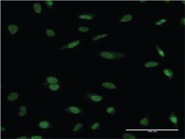 Anti-HCLS1 Mouse Monoclonal Antibody [clone: 3D5]