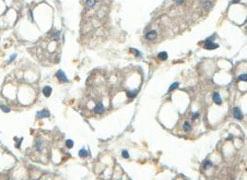 Anti-ABCF3 Rabbit Polyclonal Antibody