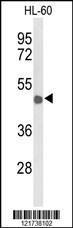 Anti-CD209 Rabbit Polyclonal Antibody (Biotin)