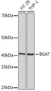 Western blot analysis of extracts of various cell lines, using Anti-ABO Antibody [ARC1251] (A306886) at 1:1000 dilution. The secondary Antibody was Goat Anti-Rabbit IgG H&L Antibody (HRP) at 1:10000 dilution. Lysates/proteins were present at 25 µg per lane