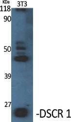 Western blot analysis of various cells using Anti-RCAN1 Antibody