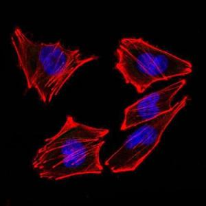 Negative Control: Immunofluorescent analysis of A2058 cells using Mouse IgG2a (AF488) - Isotype Control (Green). F-actin filaments were labeled with DyLight 554 Phalloidin (Red). DAPI was used to stain the cell nuclei (Blue)