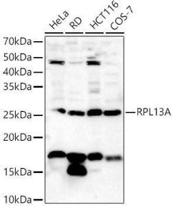 Western blot analysis of extracts of various cell lines, using Anti-RPL13A Antibody (A306887) at 1:500 dilution