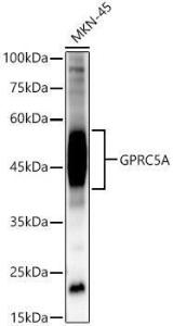 Anti-GPRC5A antibody