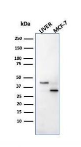 SDS-PAGE analysis of Anti-Cathepsin D Antibody [CTSD/2781] under non-reduced and reduced conditions; showing intact IgG and intact heavy and light chains, respectively. SDS-PAGE analysis confirms the integrity and purity of the antibody