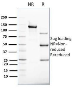 SDS-PAGE analysis of Anti-Cytokeratin 8 Antibody [B22.1] under non-reduced and reduced conditions; showing intact IgG and intact heavy and light chains, respectively. SDS-PAGE analysis confirms the integrity and purity of the Antibody