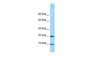 Anti-ADAT2 Rabbit Polyclonal Antibody