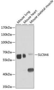 Antibody anti-SLC9A6 100 µl