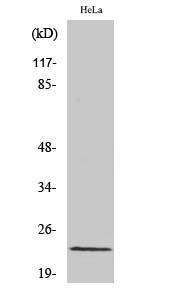 Western blot analysis of HeLa cells using Anti-RCAN1 Antibody