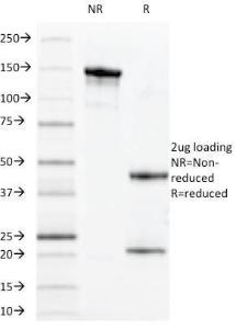 SDS-PAGE analysis of Anti-CD14 Antibody [MDA/929] under non-reduced and reduced conditions; showing intact IgG and intact heavy and light chains, respectively. SDS-PAGE analysis confirms the integrity and purity of the antibody