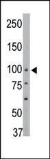 Anti-PTPN3 Rabbit Polyclonal Antibody