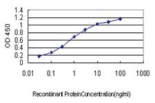 Anti-CDC42BPA Mouse Monoclonal Antibody [clone: 1G7]